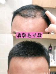 -唐风采假发补发定制