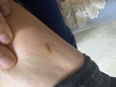 -郑远元专业修脚房·按摩·肉刺·灰指甲(天润城店)