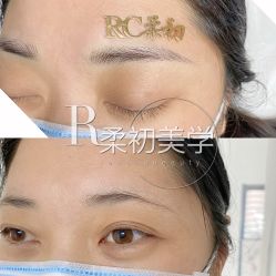 -RC半永久纹眉纹发际线