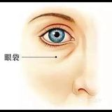 眼球就会下垂，这样就会把眼睛下面的脂肪向外挤压