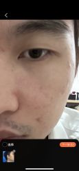 体验后-广西颜白玉医疗美容门诊部