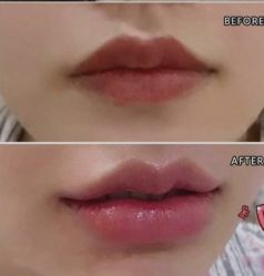 -上海漾颜医疗美容