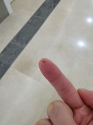 -伊丽莎白医疗美容