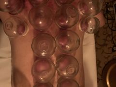 -智慧盲人按摩艾灸-颈肩腰膝疼痛调理(浦东店)