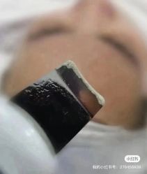 -靓芙泉祛痘.科技美肤连锁