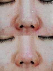 -苑苑vbeauty科技美容SPA
