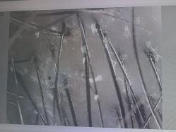 -碧莲盛·不剃发植发