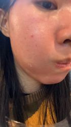 -厦门美莱整形美容医院