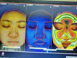 皮肤检测-光SPA科技美肤