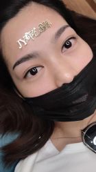 点击看大图 -郡艺医疗美容·微整·眼鼻吸脂