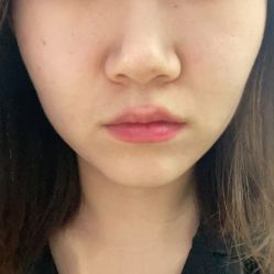 -北京米扬丽格医疗美容·联合丽格鼻整形中心