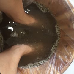 -派恩宜灰指甲·甲沟炎·鸡眼康护