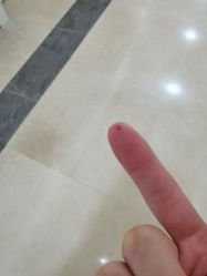 -伊丽莎白医疗美容