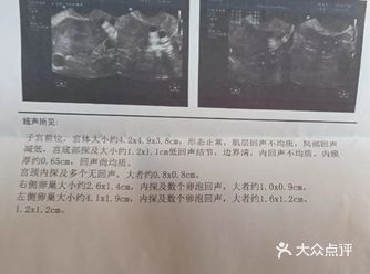 月经不调有种，你是属于哪一种？