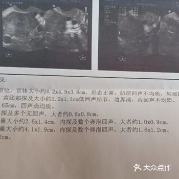 月经不调有种,你是属于哪一种?