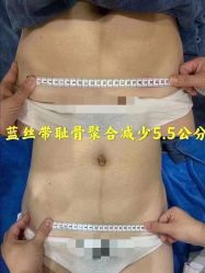 -蓝丝带催乳产康产后恢复中心(殷巷店)