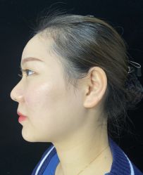 -洁铭新加坡医美