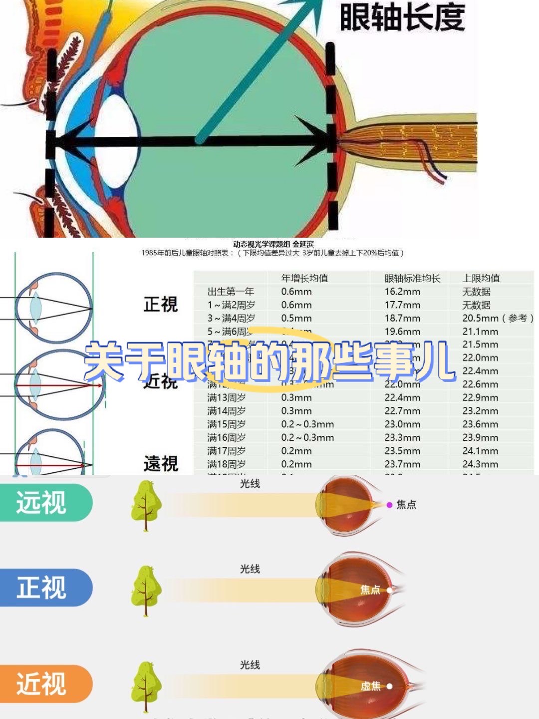 近视眼与正常眼图片