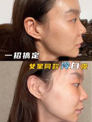 -新美荟医美·专注面部美学抗衰