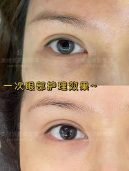 -MLP美丽派·问题肌疗愈中心