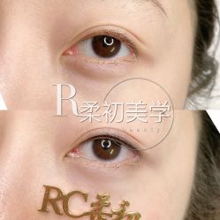 -RC半永久纹眉纹发际线