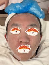 -塑青春&伊肤泉祛痘皮肤管理