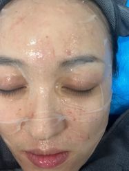 -More摩尔医美の注射线雕光电中心