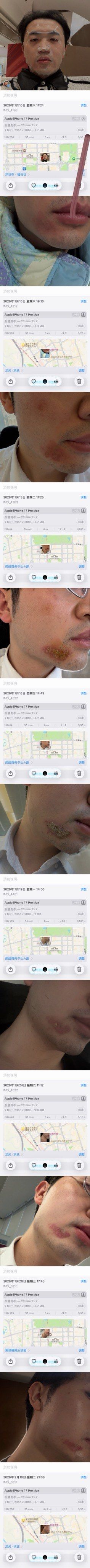 -深圳米兰柏羽医疗美容医院