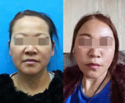 -加减美医美连锁品牌