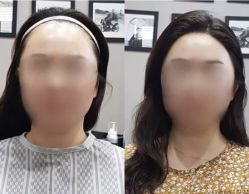 -发饰美男士增发补发假发定制店