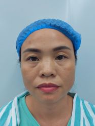 -天津健丽·去眼袋医疗美容机构