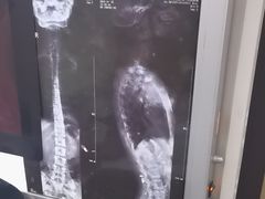 -张钰强中医正骨推拿连锁(华发商都店)