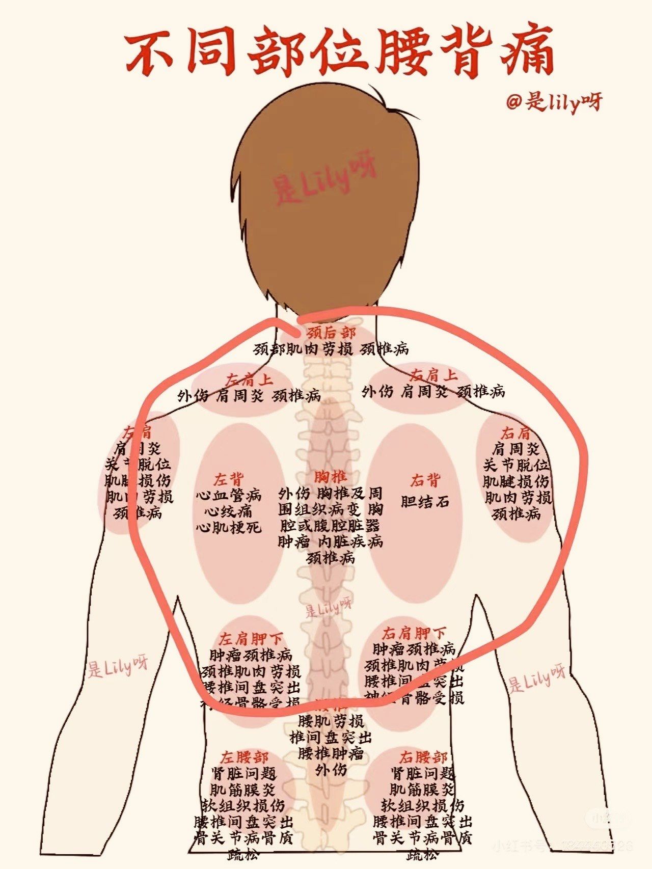 不同背部痛背的对号入座#中医养生 #穴位