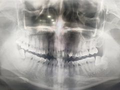 -同步齿科·数字化正畸种植口腔中心(前山店)