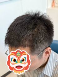 点击看大图 -大麦微针植发全国连锁