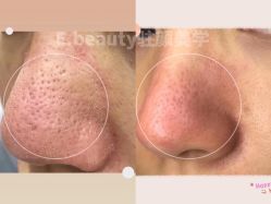 -E.beauty驻颜·痘敏肌调理中心