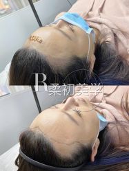 -RC半永久纹眉纹发际线