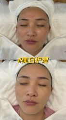 -ANNIL安奈尔·NASX超透白·科技抗衰·问题性肌肤管理