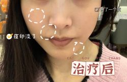 点击看大图 -成都艾特他整形外科医院