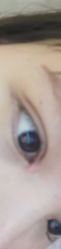 -铂特丽医美·眼鼻整形·光电美肤·注射抗衰