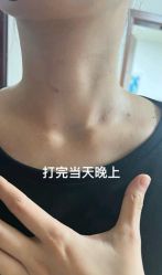 -深圳阳光医疗美容医院·旗舰店