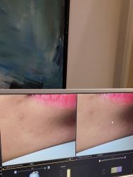 -苑苑vbeauty科技美容SPA