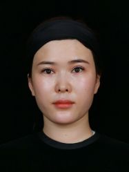 体验后-南宁华美医疗美容医院