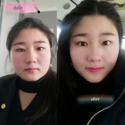-肥三针腧穴瘦身馆
