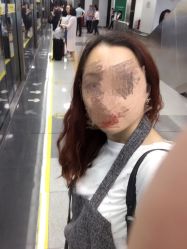 -瑞尼丝国际专业脱毛连锁