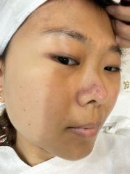 体验前-坤如玛丽·医疗美容中心