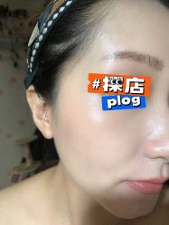 点击看大图 体验后-北京英煌医疗美容