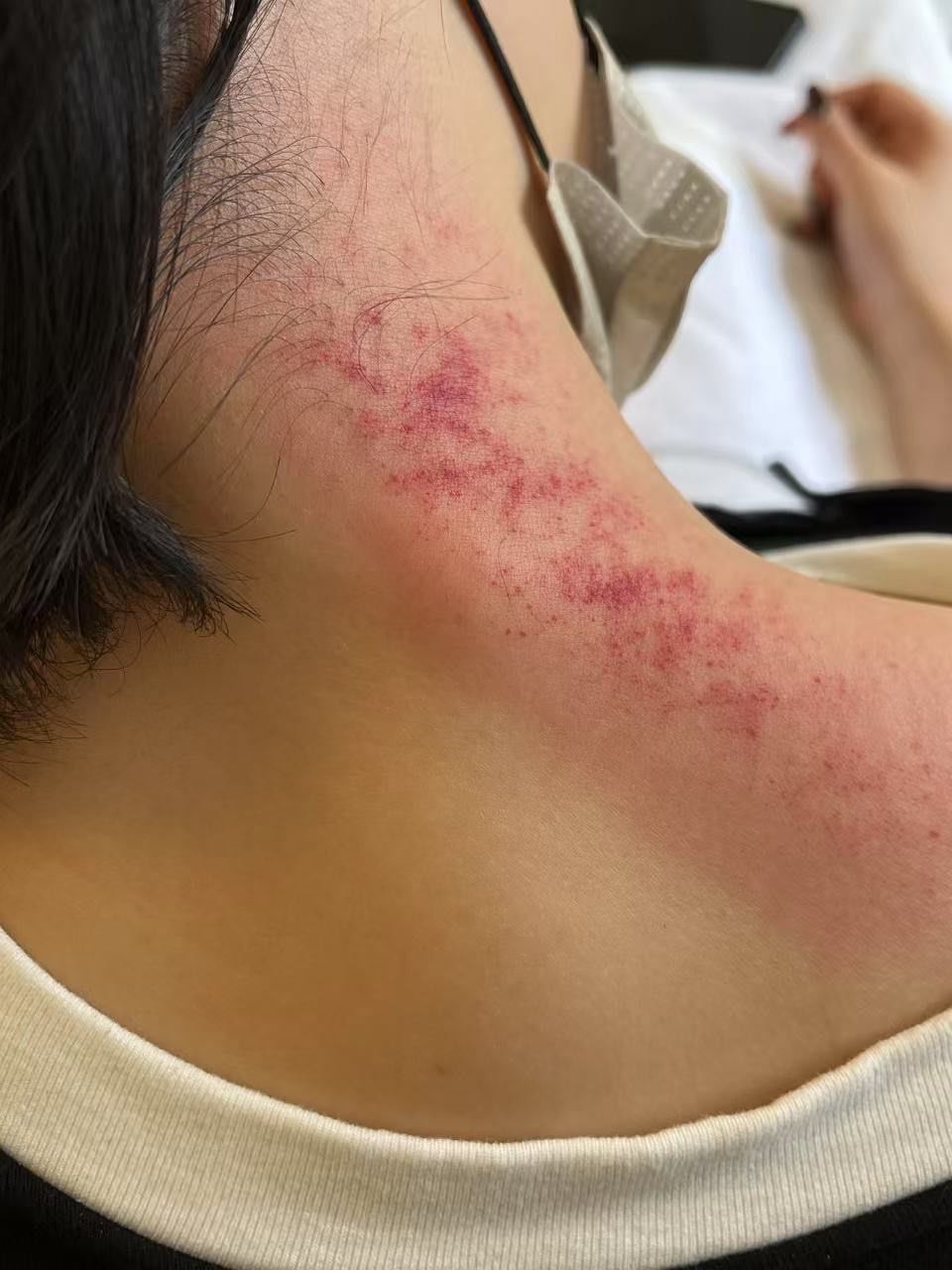 保持健康,从刮痧开始