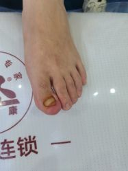 点击看大图 -爱足康修脚·甲沟炎·艾灸养生馆