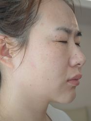 -清疣美疣·痣·斑净肤中心